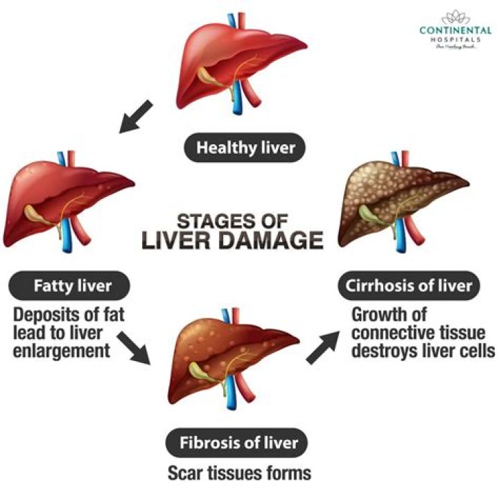 Can lemon cause liver damage?