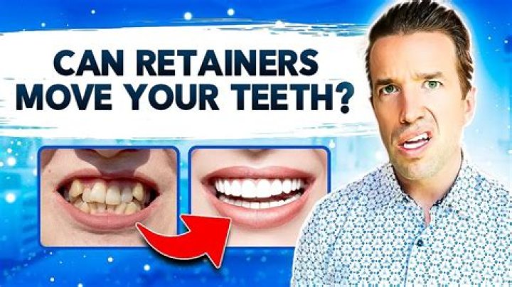 Can retainers melt in your mouth?