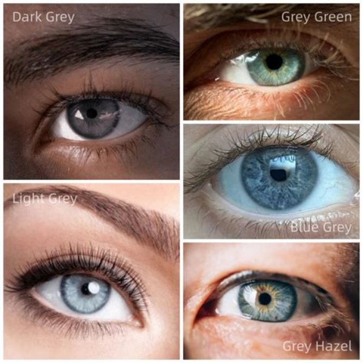 Do people have GREY eyes?