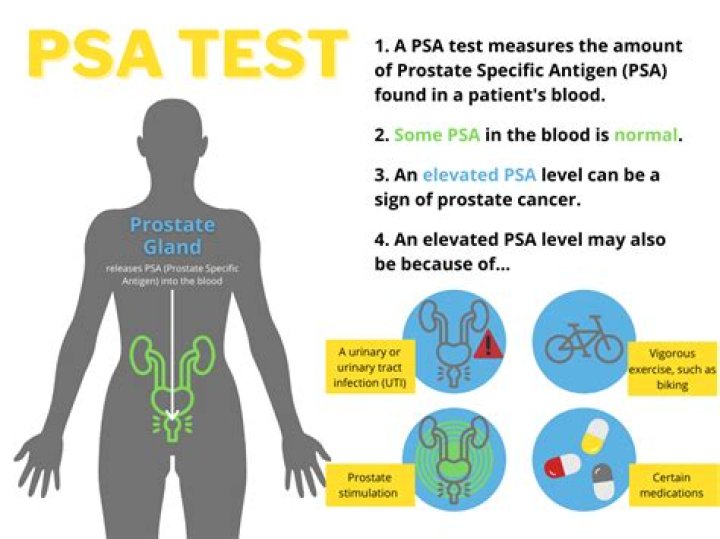 How accurate is PSA test?