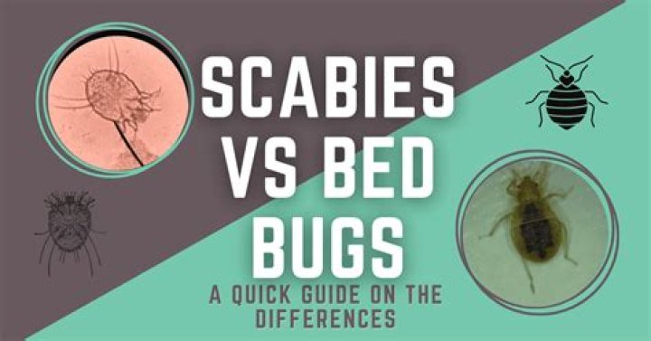 How can you tell the difference between bed bugs and scabies?