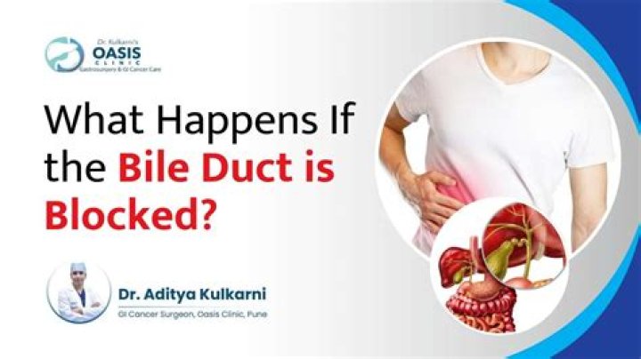 How do you know if your bile duct is blocked?