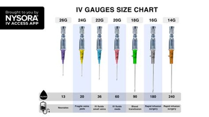 How do you start gauges?