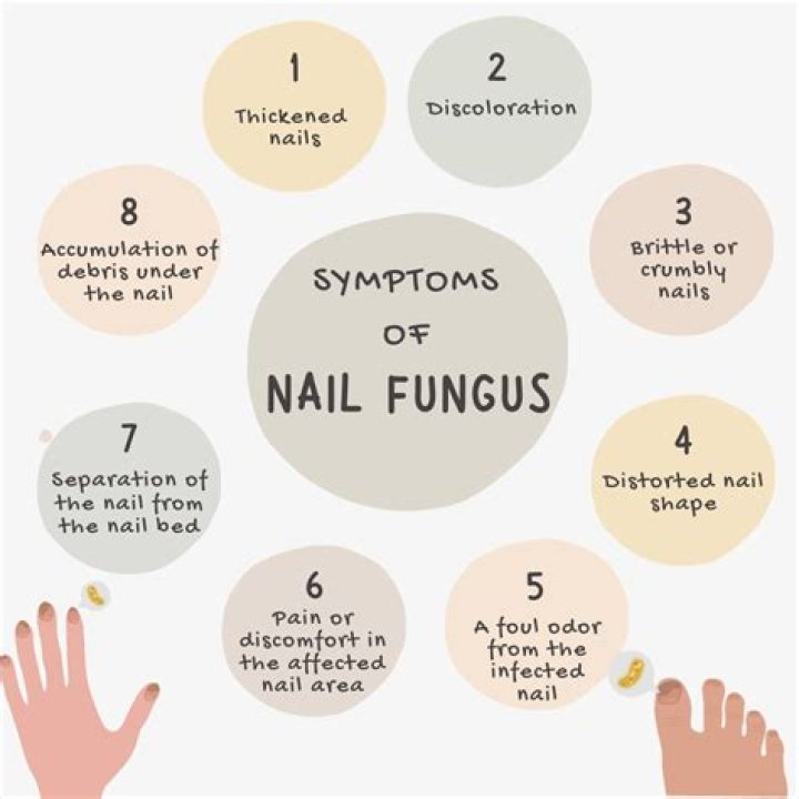 Should I file down my nail fungus?