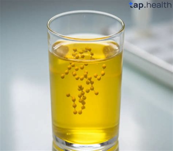 Should I stop taking vitamin B if urine is yellow?