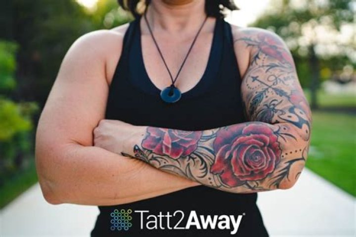 What happens to tattoos when you get pregnant?