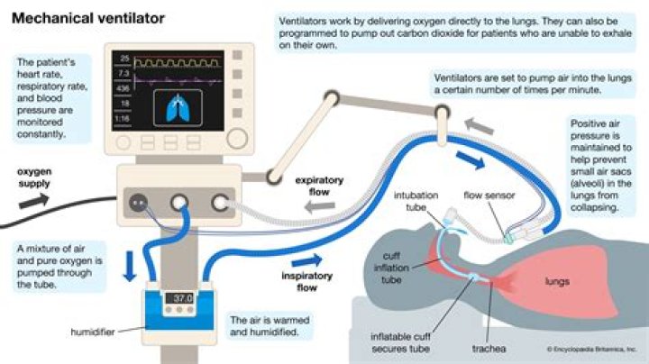 What is the difference between being intubated and on a ventilator?